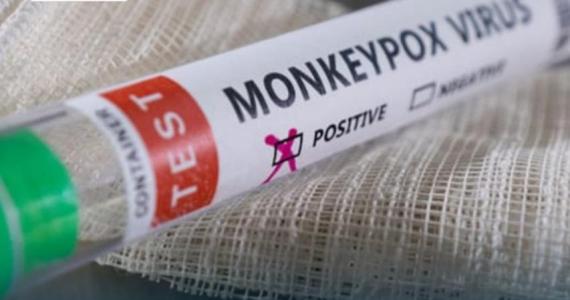 immediate-steps-urged-as-monkeypox-symptoms-emerge-recognize-and-respond-early