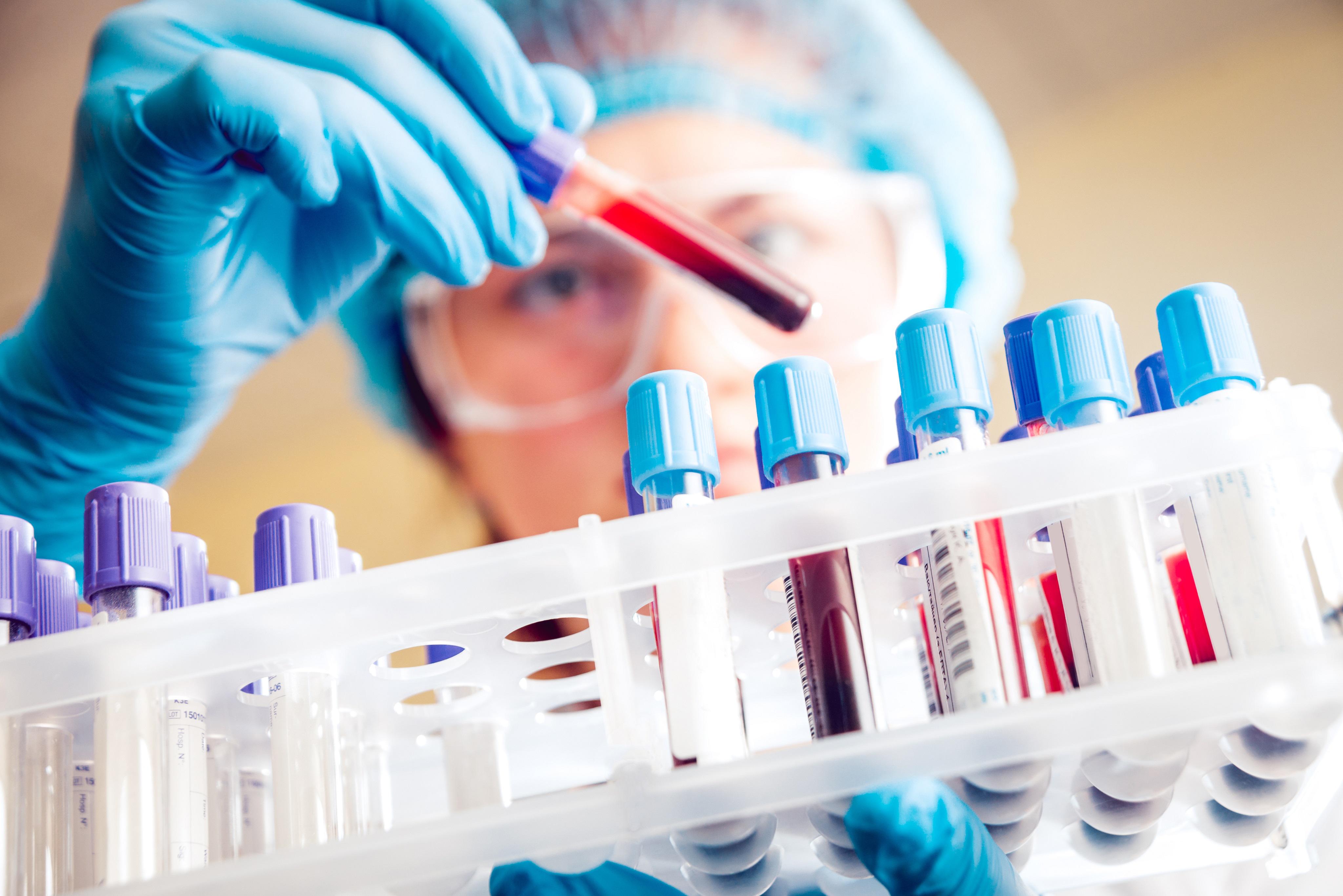 kp-sets-uniform-rates-for-diagnostic-tests-across-all-public-hospitals