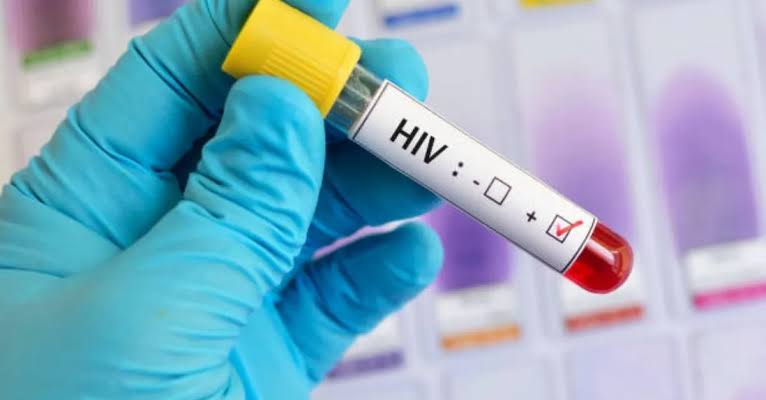 who-unaids-sound-alarm-as-hiv-cases-surge-across-pakistan