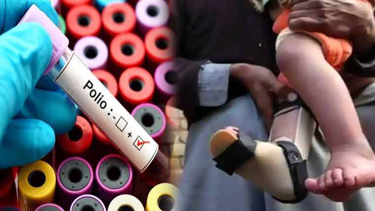 another-polio-case-detected-in-kp-infant-in-north-waziristan-affected
