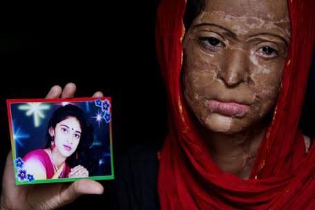 the-first-hour-after-an-acid-attack-could-save-a-faceand-a-future