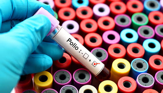 khyber-reports-first-polio-case-in-six-and-a-half-years