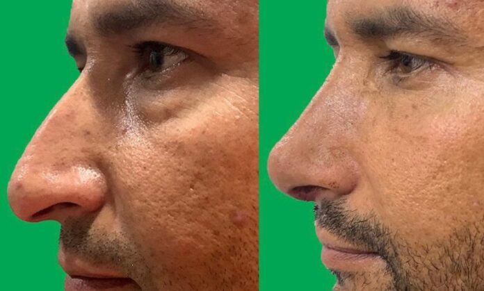 Unveiling the Realities of Cosmetic Surgery